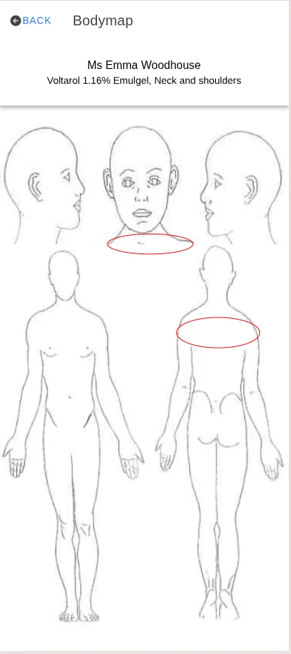A body map in the care worker app showing where to apply a cream on the neck and shoulders